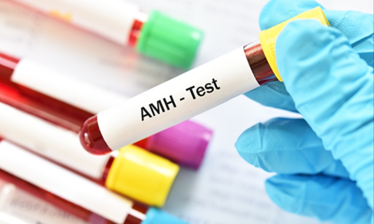 Accurate Info Reduces Women's Interest in AMH Test, Study Finds