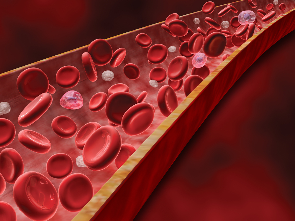 Comparison of Blood Tests for Alzheimer's Diagnosis Reveals Accuracy, Highlights Importance of Early Detection