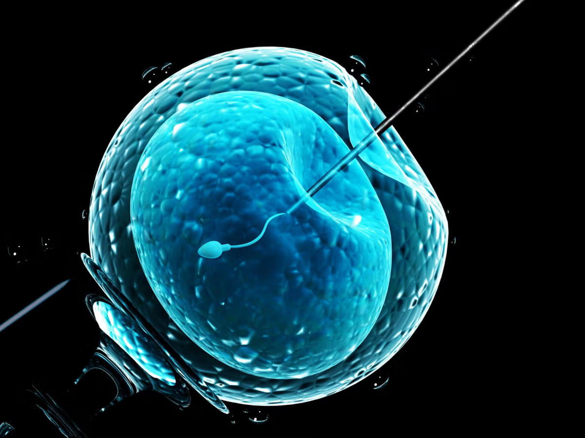 IVF and IUI Treatments Increase Among European Women, Reflecting Higher Use of Assisted Reproductive Technology