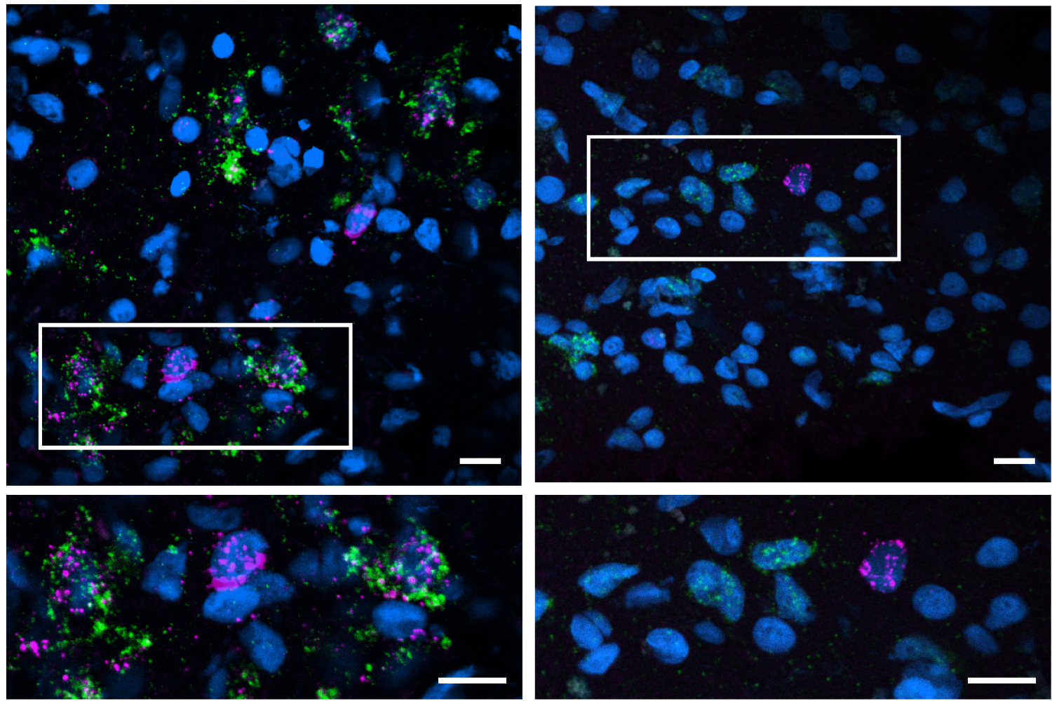 MIT Study in *Nature* Identifies Cellular Vulnerabilities in Alzheimer's, Potential Cognitive Resilience Factors