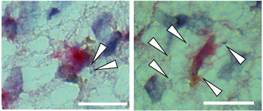 MIT Study in *Nature* Identifies Cellular Vulnerabilities in Alzheimer's, Potential Cognitive Resilience Factors