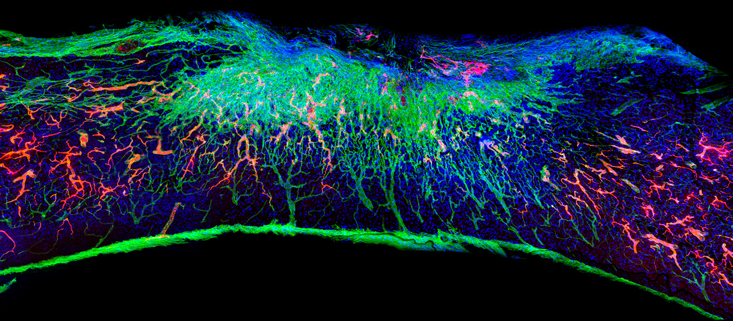 Northwestern University Develops Injectable Therapy Using "Dancing Molecules" for Cartilage Regeneration and Spinal Cord Repair