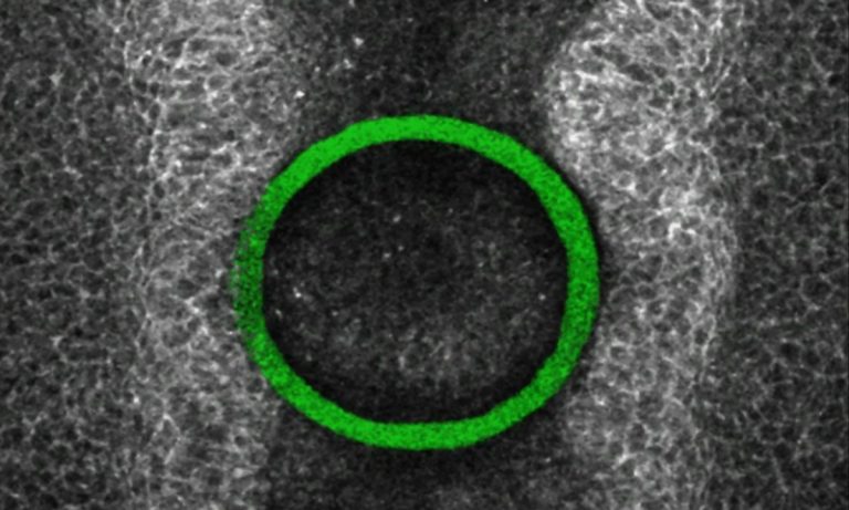 Pioneering Mechanical Force Sensors Illuminate Embryonic Development and Birth Defect Prevention