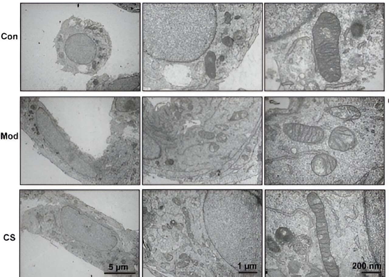 Study Shows Cordyceps Sinensis Reduces Pulmonary Fibrosis in Mice by Targeting Oxidative Stress