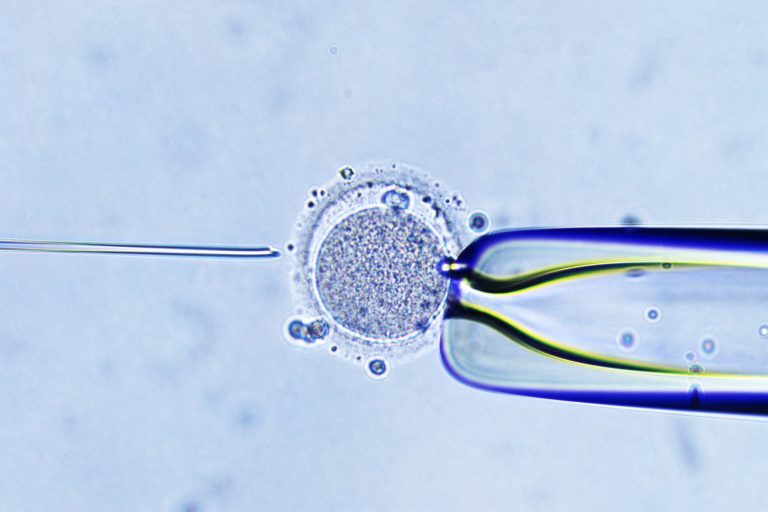 Study Shows Time-Lapse Imaging Does Not Improve IVF Outcomes