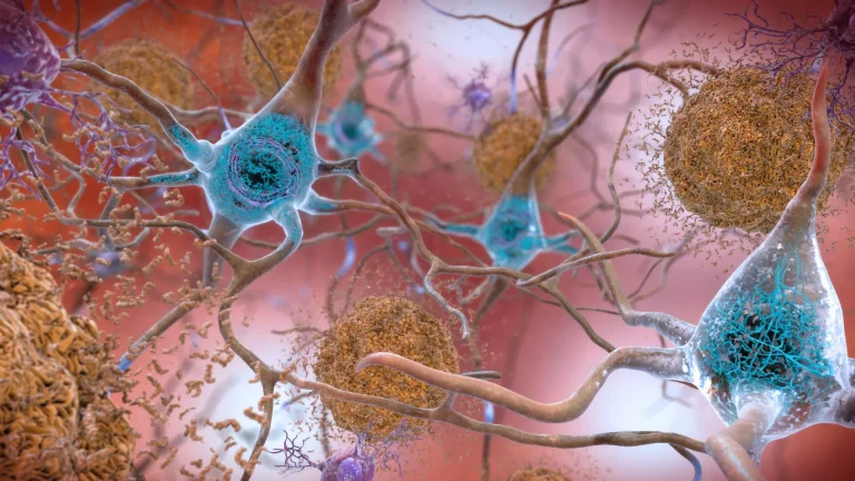 Alzheimer's Research Faces New Controversies and Theories as Focus Shifts from Beta-Amyloid