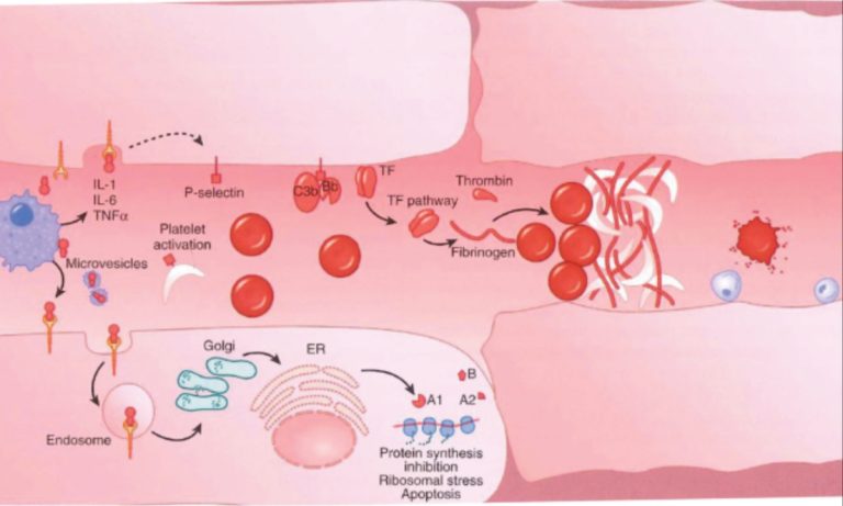 Italy Reported 68 Hemolytic Uremic Syndrome Cases in the Past Year, Predominantly in Children, With Notable Regional and Seasonal Variations