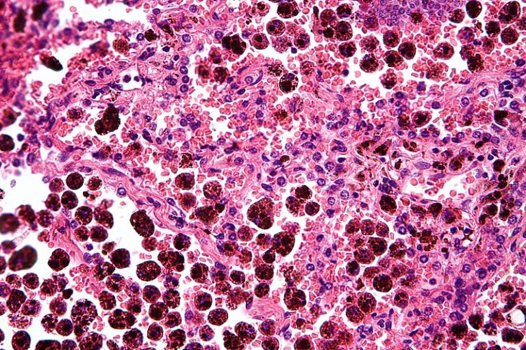 New Macrophage Type Identified in Lung Repair After Viral Injury by University of Liège Researchers