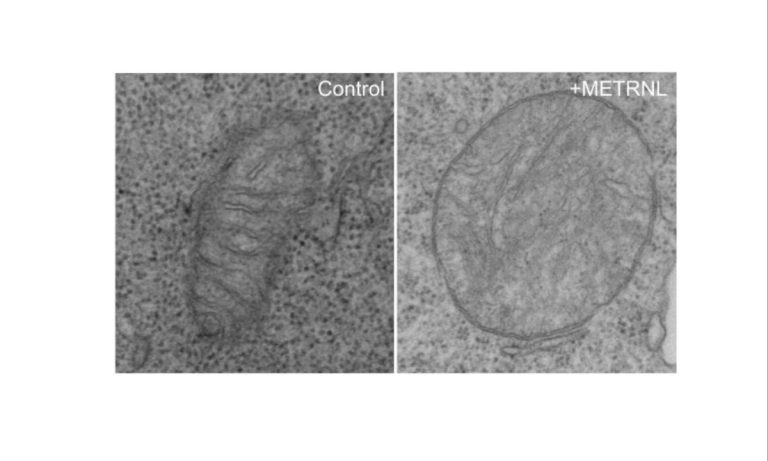 Research Reveals How METRNL Protein Impairs T Cell Function in Cancer