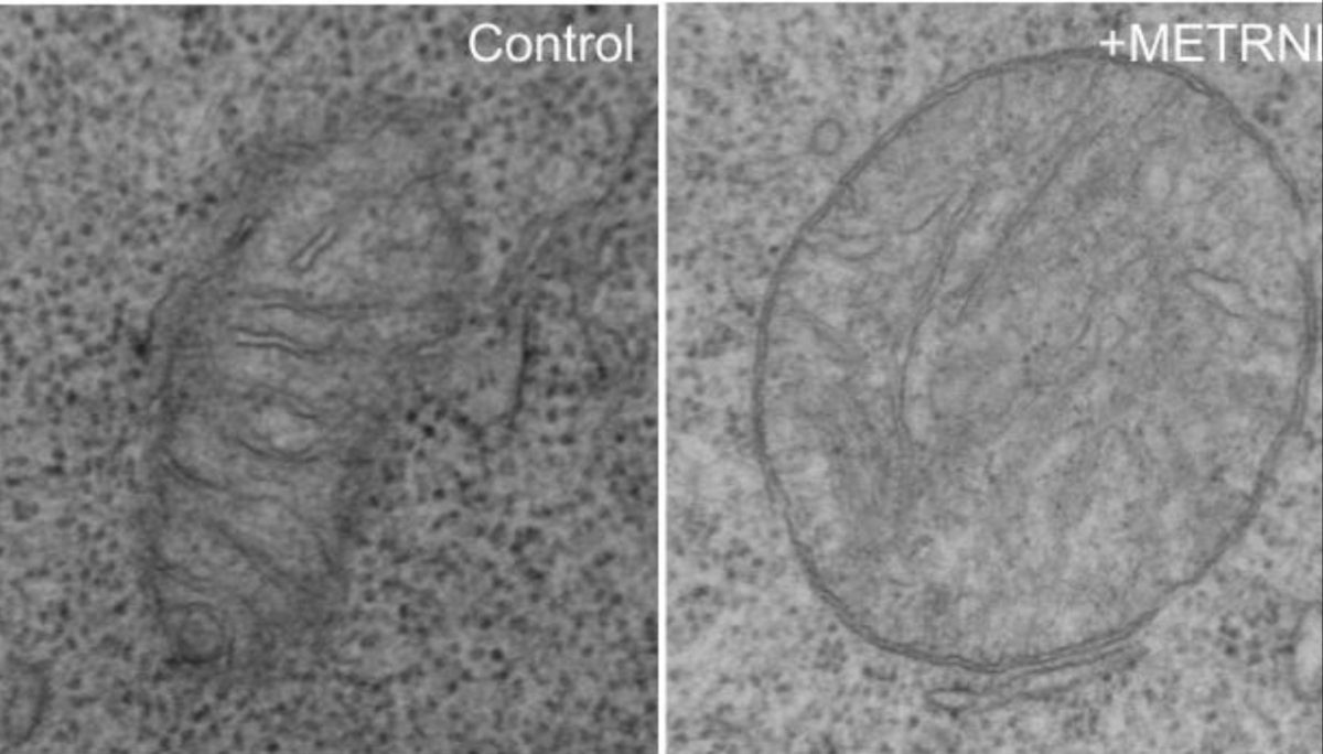 Research Reveals How METRNL Protein Impairs T Cell Function in Cancer