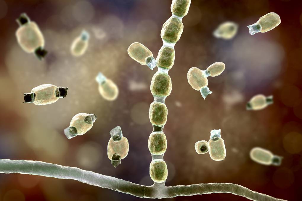 Valley Fever Cases Surge in California, Spreading Beyond Traditional Regions Amid Changing Climate