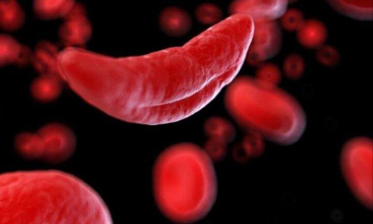 European Medicines Agency Recommends Suspension of Oxbryta Due to Emerging Safety Concerns in Sickle Cell Treatment