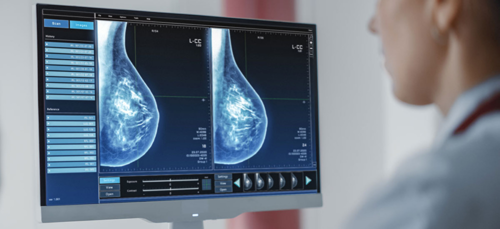 FDA Requires Mammogram Facilities to Report Breast Density to Patients Amid Coverage Concerns