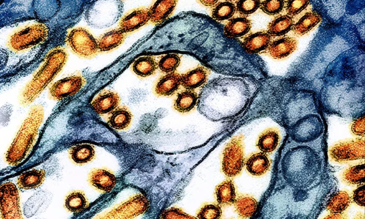 Four More Health Workers Develop Symptoms After Exposure to H5N1 Bird Flu Patient, CDC Reports