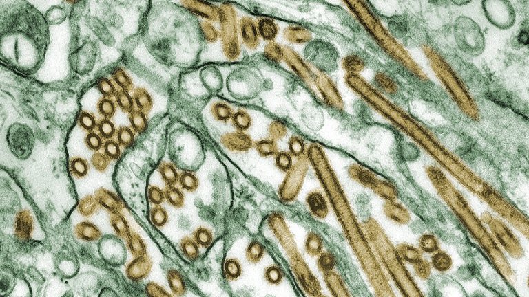 Four More Health Workers Develop Symptoms After Exposure to H5N1 Bird Flu Patient, CDC Reports