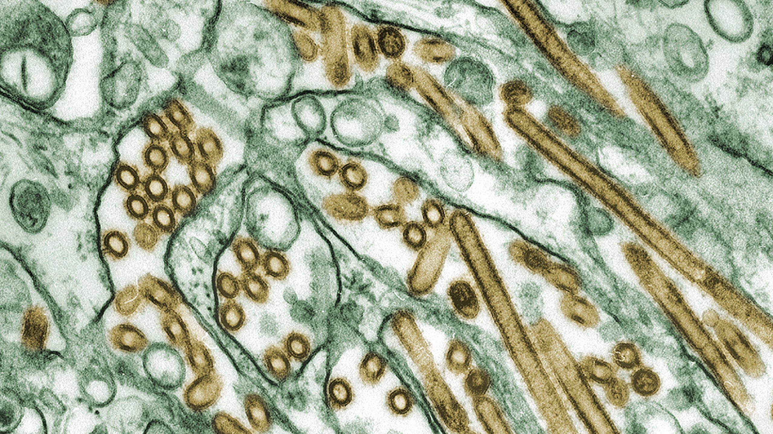 Four More Health Workers Develop Symptoms After Exposure to H5N1 Bird Flu Patient, CDC Reports