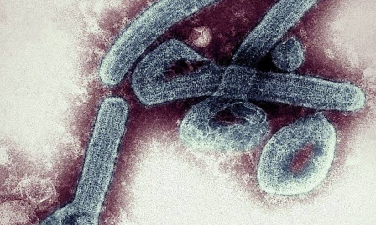 Rwanda's Marburg Virus Outbreak Claims Six Lives, Including Healthcare Workers, as Authorities Intensify Response