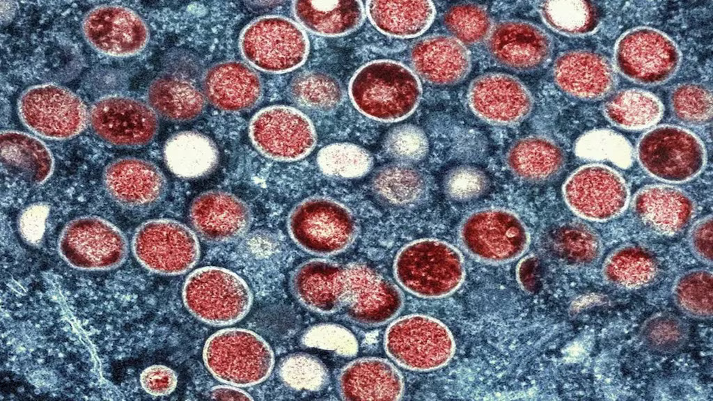 WHO Issues Health Alert as India Detects First Case of Fast-Spreading Mpox Variant