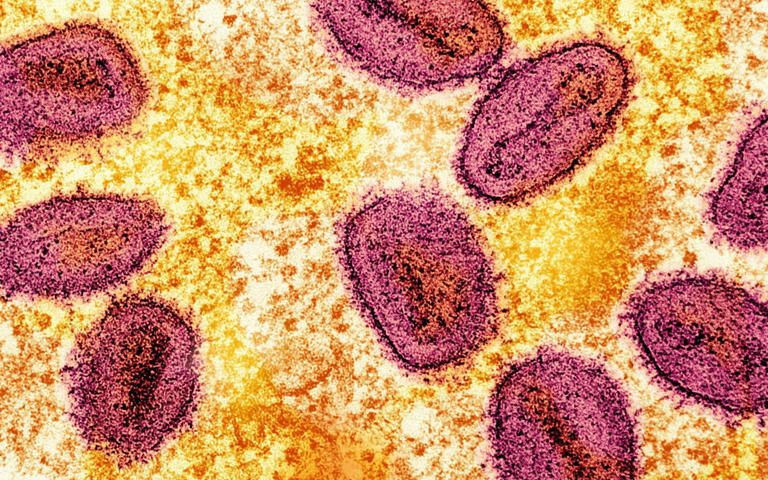 Germany Detects Mpox Case from Abroad, Authorities Monitor for Potential Risks