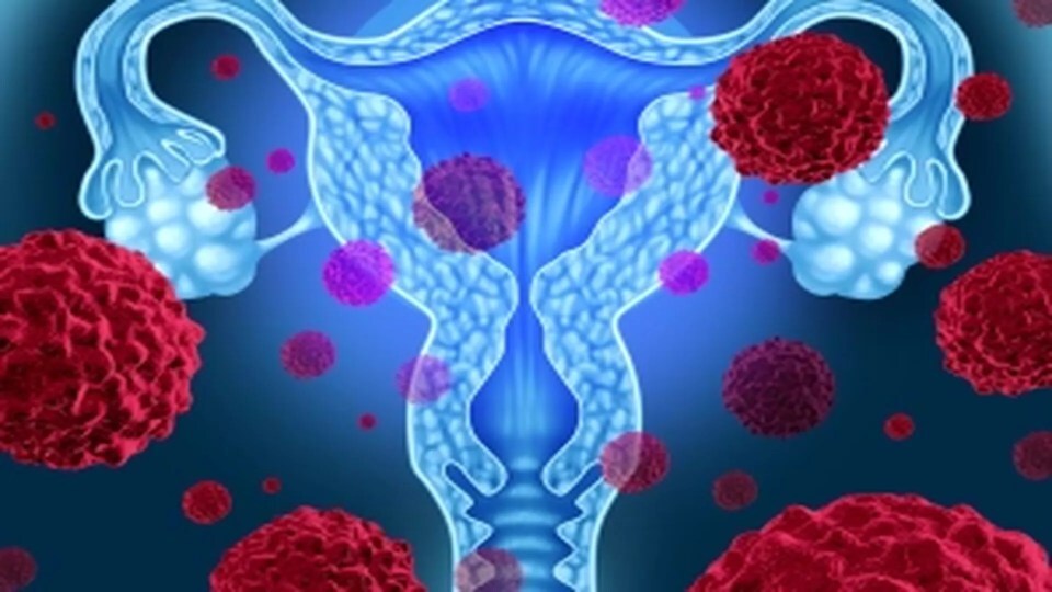 Groundbreaking Cervical Cancer Treatment Cuts Death Risk by 40% in Major Medical Breakthrough