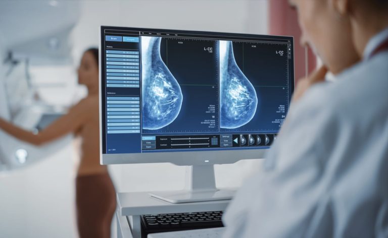 New Research Links Dense Breast Tissue to Higher Cancer Risk and Complicates Tumor Detection