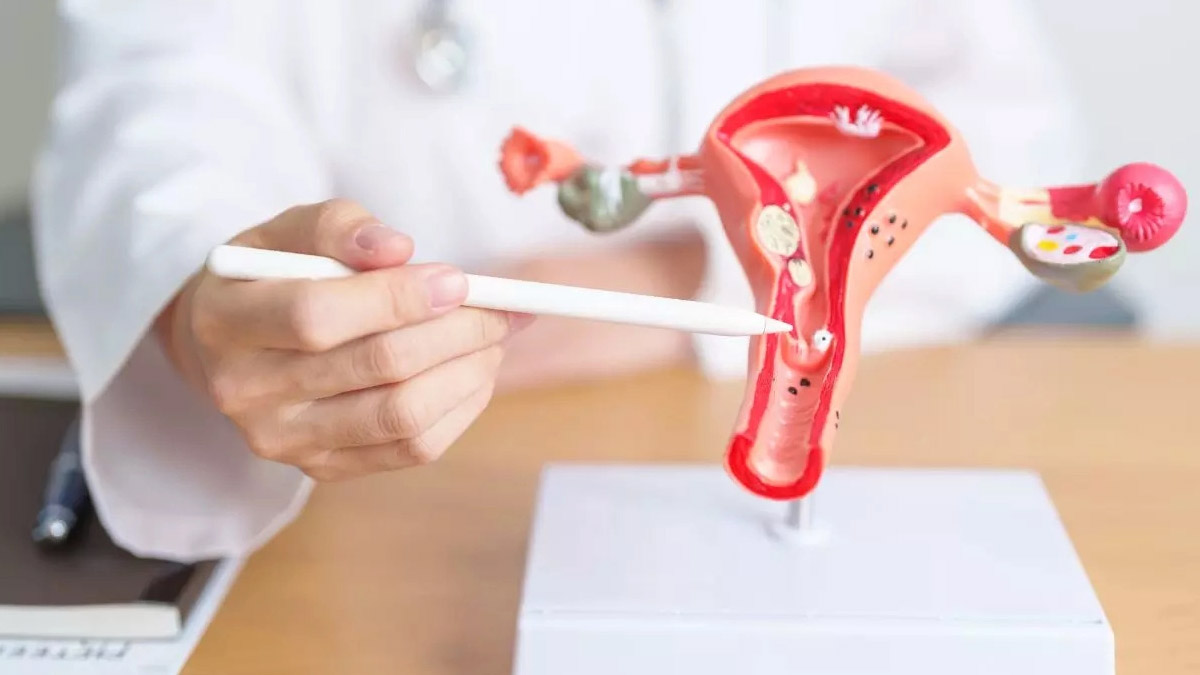 Promising Cervical Cancer Treatment Strategy Reduces Death Risk and Recurrence, Study Finds