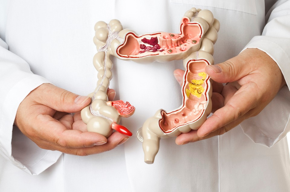 Study Reveals Rising Colon Cancer Rates Among Younger Adults, Highlighting Key Risk Factors and Urging Early Screening