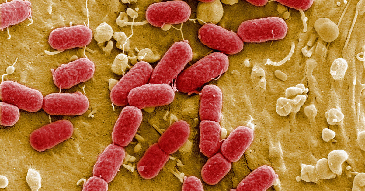 E. Coli Outbreak Linked to St. Louis Catering Company Amid Ongoing Investigation and Lawsuits