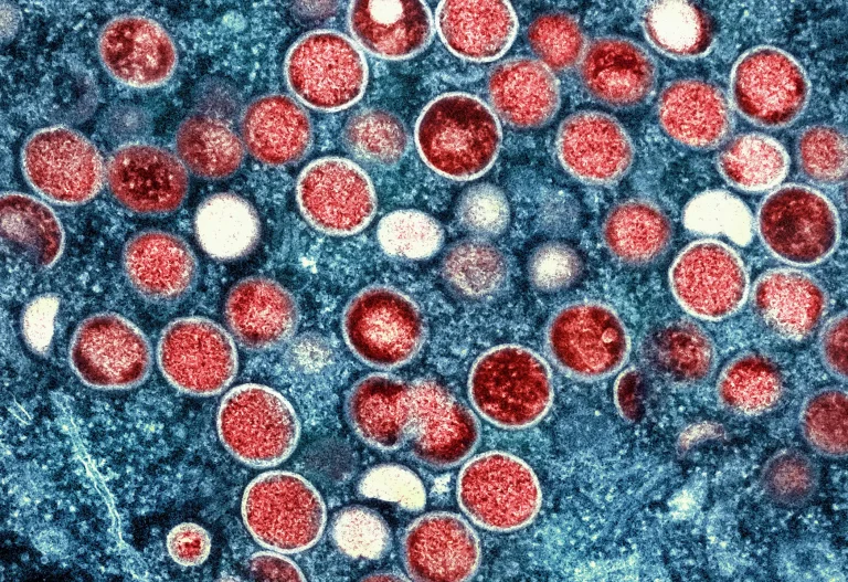 Mpox Outbreak in Congo Stabilizes as Infections Plateau Amid Efforts to Contain New Variant Spread