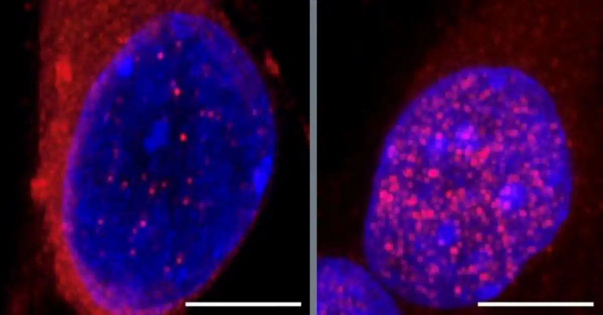 New ALS Study Identifies Protein Pathway That Could Unlock Early Treatment Possibilities