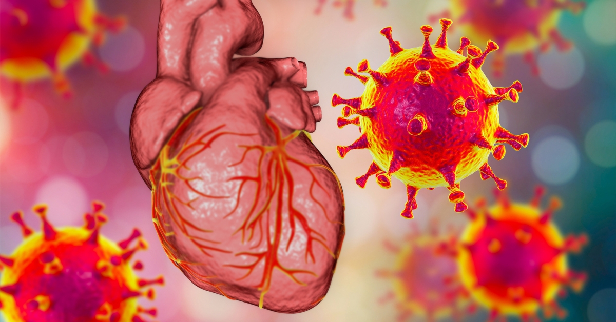 Study Links Early COVID-19 Infections to Long-Term Cardiovascular Risks, Including Heart Attack and Stroke