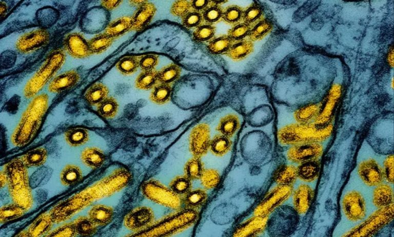 Louisiana Resident Hospitalized with Presumptive H5N1 Bird Flu Case Amid Growing Concerns