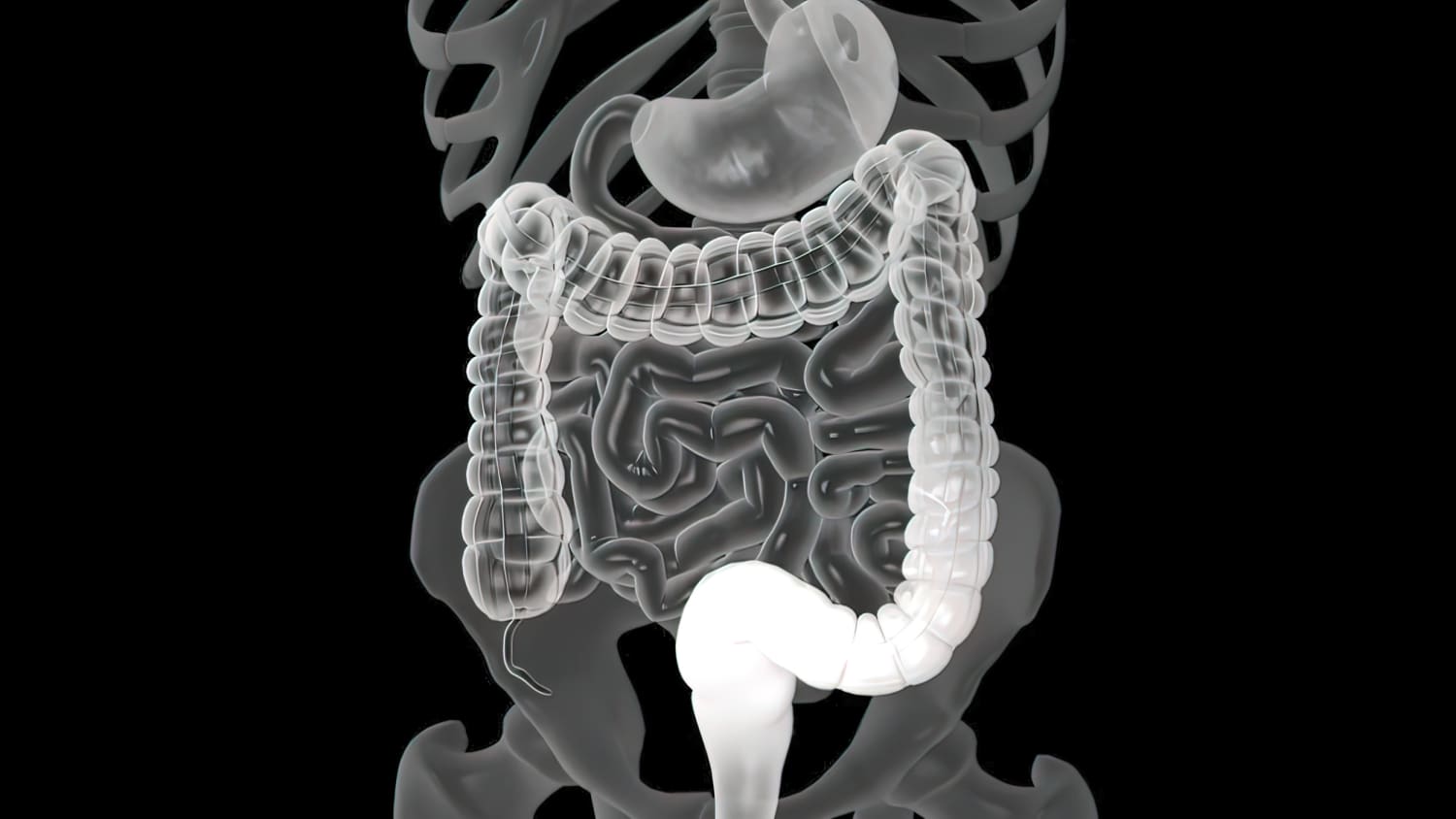 Rising Colorectal Cancer in Young Adults Highlights Importance of Recognizing Symptoms Like Pencil-Thin Stools