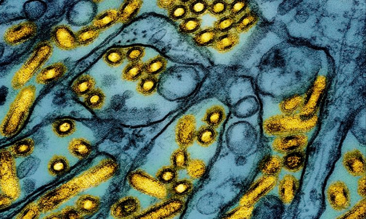 Severe Bird Flu Case in Louisiana Highlights Rising Human Risk Amid Ongoing U.S. Outbreak